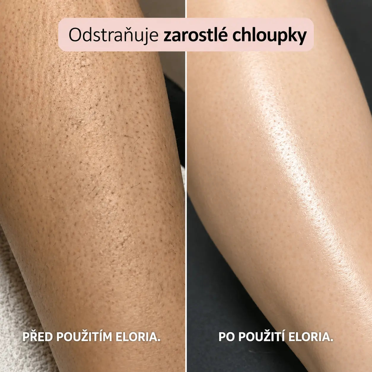 Holicí strojek Eloria